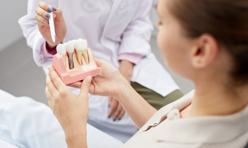 All-in-4 and All-in-6 Implants- Everything You Need to Know