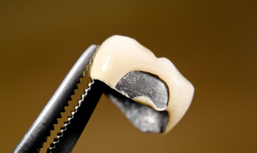 What to Do If Your Dental Crown Gets Loose or Broken