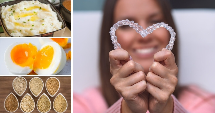 food habits to get a better experience after invisalign