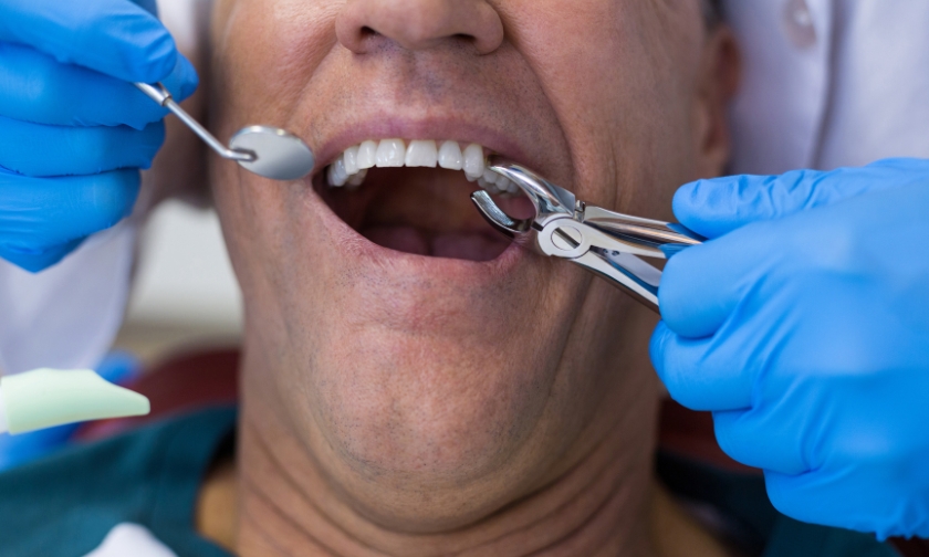 Wisdom Teeth Removal Pain: Tips For A Smooth Recovery