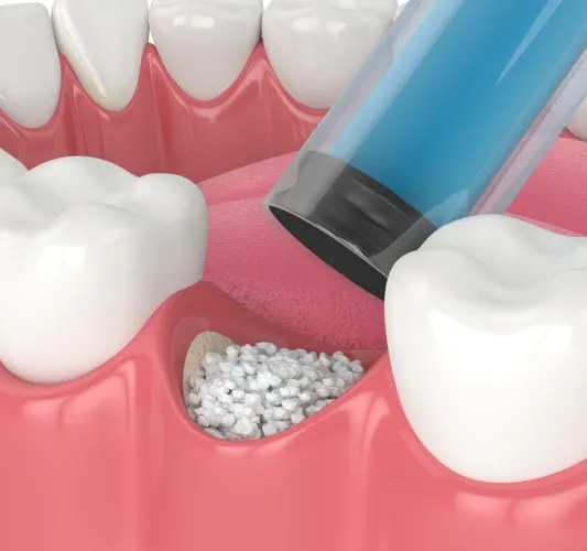 Bone Grafting Howell – dentist reviewing digital X-rays before implant planning at Riverpark Dental of Howell