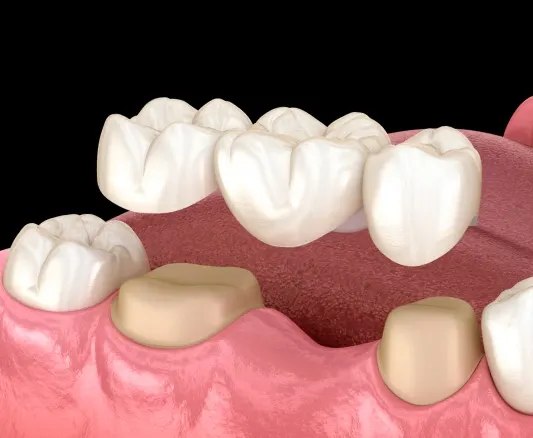Dental Crowns Howell – dentist checking a crown's fit with a patient at Riverpark Dental of Howell