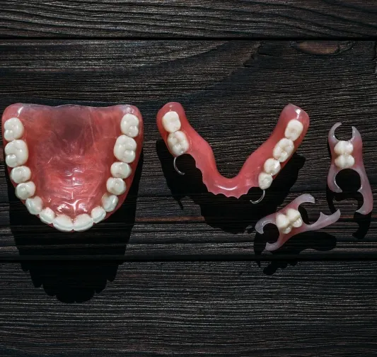 Snap-In Dentures Howell – implant-supported denture model at Riverpark Dental of Howell