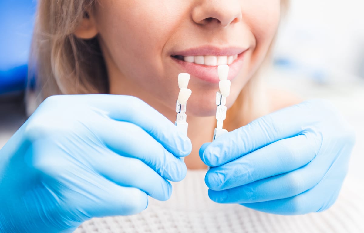 Veneers in Howell Township